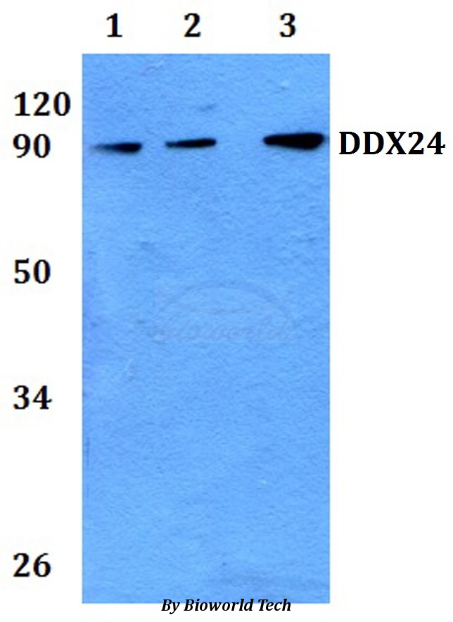 Anti-DDX24 Antibody