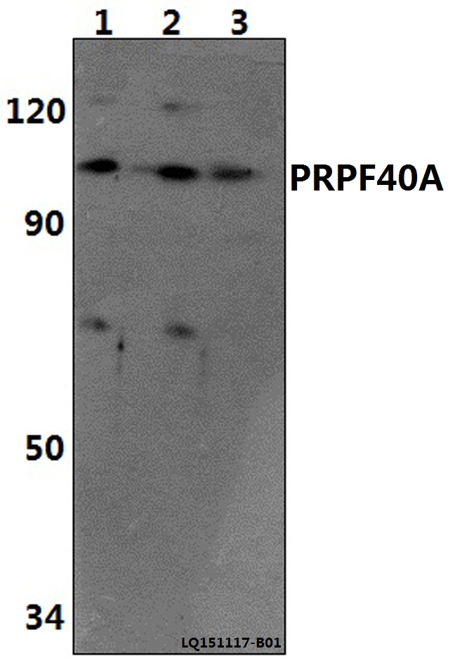 Anti-PRPF40A Antibody