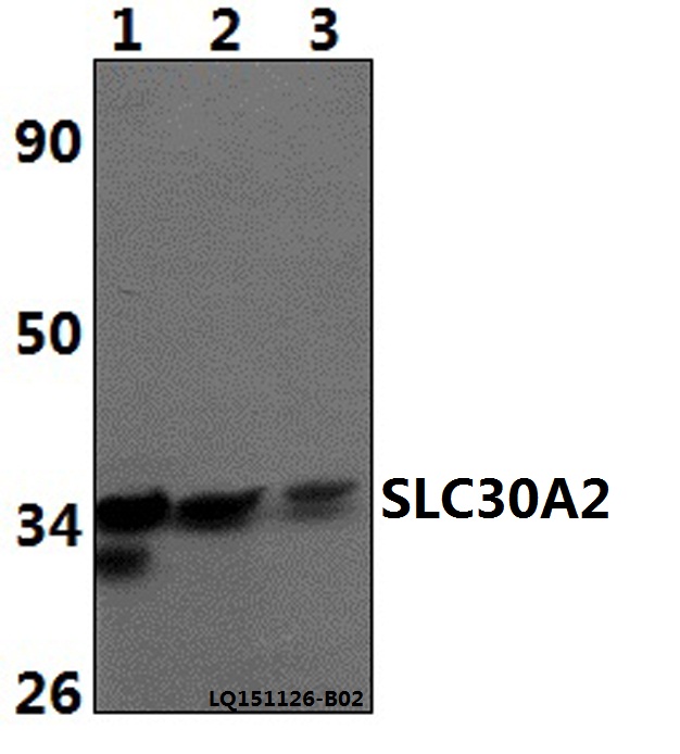 Anti-SLC30A2 Antibody