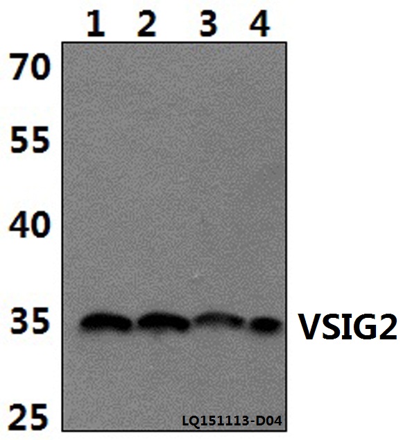 Anti-VSIG2 Antibody