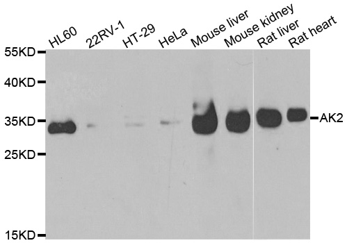 Anti-AK2 Antibody