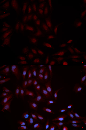 Anti-p38/MAPK14 (phospho-Y322) Antibody