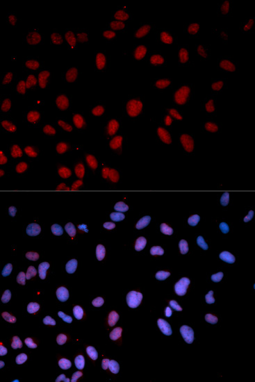 Anti-p38/MAPK14 (phospho-T180) Antibody