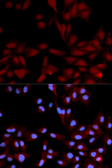 Anti-p38/MAPK14 (phospho-Y182) Antibody