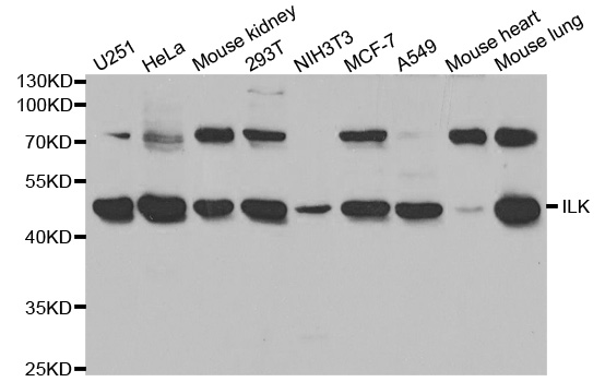 Anti-ILK Antibody