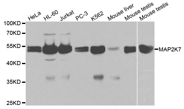 Anti-MKK7/MAP2K7 Antibody