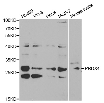 Anti-PRDX4 Antibody