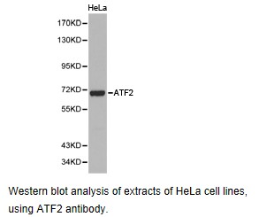 Anti-ATF2 Antibody