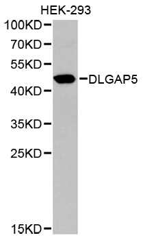Anti-DLGAP5 Antibody