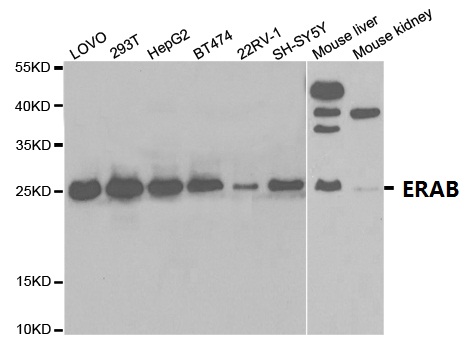 Anti-ERAB Antibody