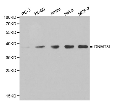 Anti-DNMT3L (ChIP Grade) Antibody