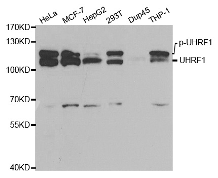 Anti-UHRF1 (ChIP Grade) Antibody