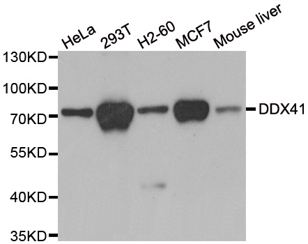 Anti-DDX41 Antibody