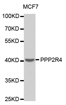 Anti-PPP2R4 Antibody