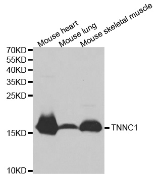 Anti-TNNC1 Antibody