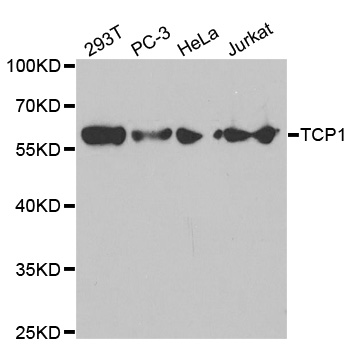 Anti-TCP1 Antibody