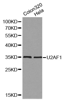 Anti-U2AF1 Antibody