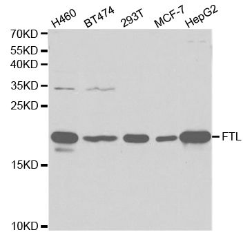 Anti-FTL Antibody