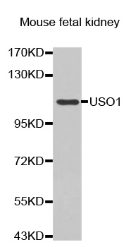 Anti-USO1 Antibody
