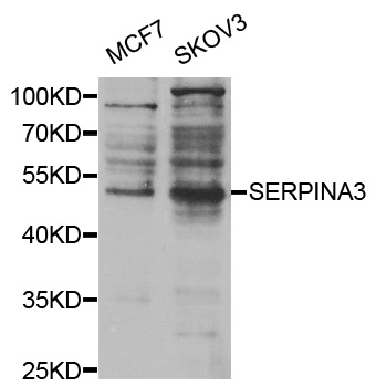Anti-SERPINA3 Antibody