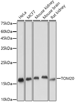 Anti-TOMM20 Antibody [ARC5002-01]