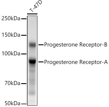 Anti-Progesterone Receptor Antibody [ARC5121-01]