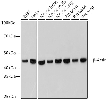 Anti-beta Actin Antibody [ARC5115-01]