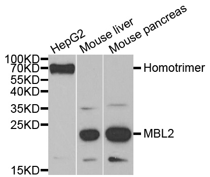 Anti-MBL2 Antibody