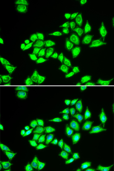 Anti-TPD52L1 Antibody