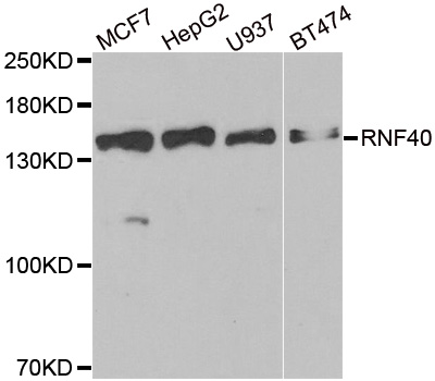 Anti-RNF40 Antibody