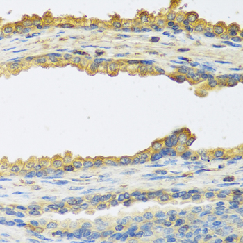 Anti-TSHB Antibody