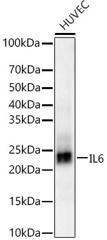 Anti-IL-6 Antibody [ARC5093-01]