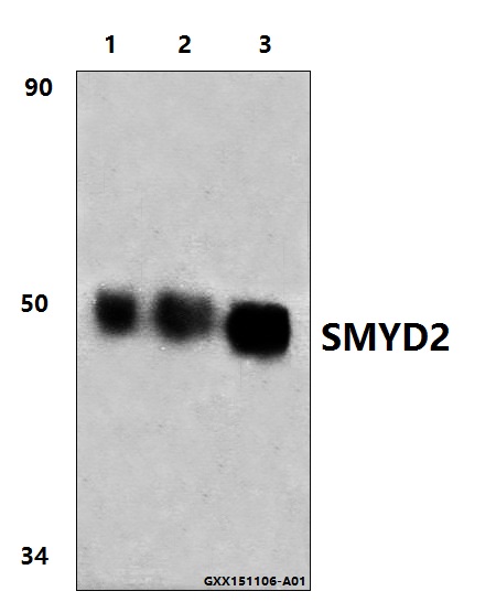 Anti-SMYD2 (L148) Antibody