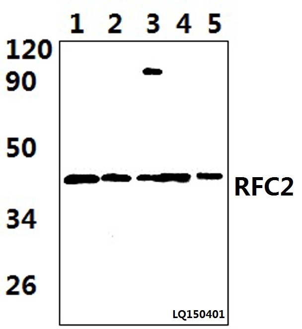 Anti-RFC2 (T165) Antibody
