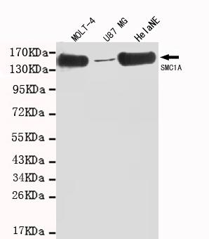 Anti-SMC1A (C-terminus) Antibody