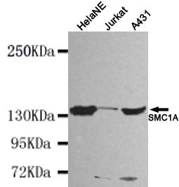 Anti-SMC1A (N-terminus) Antibody