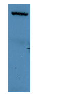 Anti-PML Protein Antibody [B4C8]