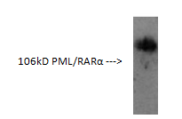 Anti-PML Protein Antibody