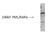 Anti-PML Protein Antibody