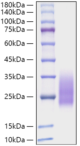 Recombinant Monkeypox Virus A30L Protein (C-Terminal 6x His Tag)