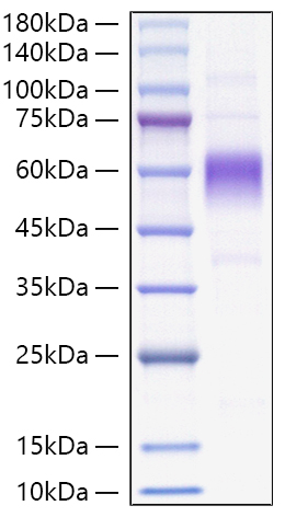 Recombinant Monkeypox Virus B16R Protein (C-Terminal 6x His Tag)