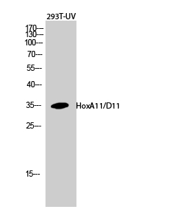 Anti-HoxA11 / D11 Antibody