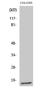 Anti-Ribosomal Protein L27A Antibody