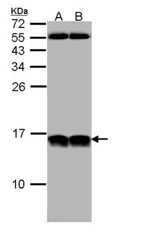 Anti-NHP2-like protein 1 Antibody