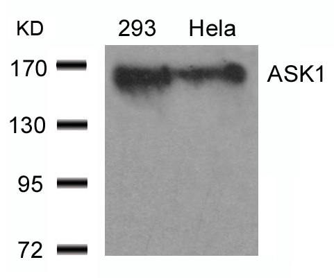 Anti-ASK1 (Ab-966) Antibody