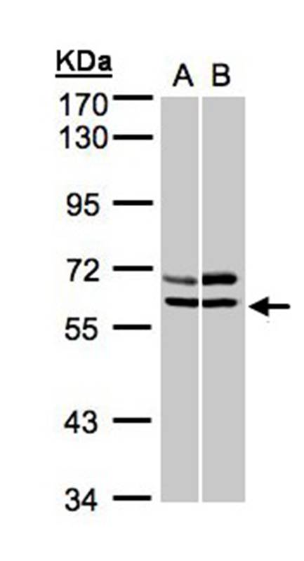 Anti-AMPK alpha 2 Antibody