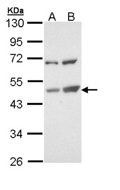 Anti-TSPYL1 Antibody