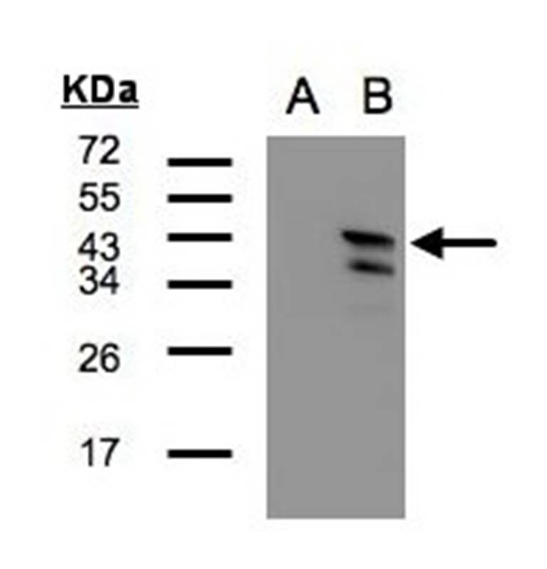 Anti-CAMK1D Antibody