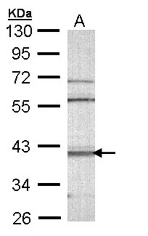 Anti-CAMK1D Antibody