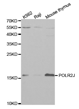 Anti-POLR2J Antibody